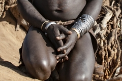 Hand in Arm Omo Valley Ethiopia