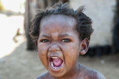 San Child Scream Tsumkwe Otjozondjupa Region Namibia